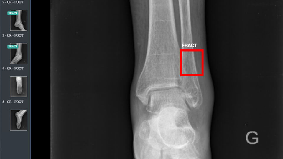 Radiographie capture d'écran